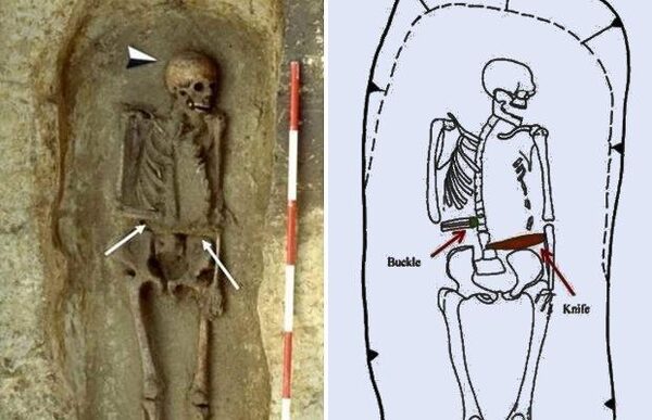 Антропологи удивлены: в Италии нашли скелет средневекового киборга с ножом вместо руки