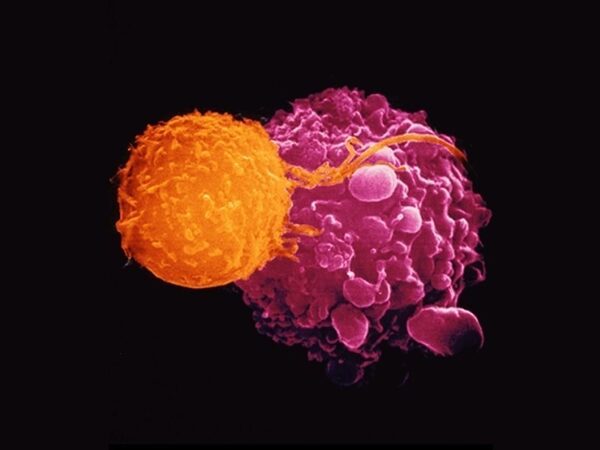 Анализ крови сможет выявить рак за годы до первых симптомов