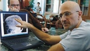 Хирург Сержио Канаверо стал на шаг ближе к пересадке человеческой головы?