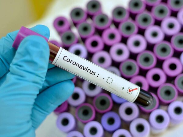 Китайский коронавирус пошел на спад - ВОЗ