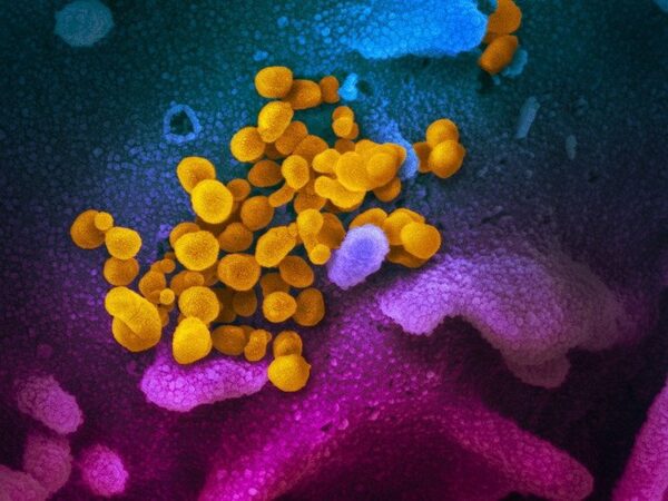 Исследователи предсказали возможные цели для эффективного иммунного ответа на новый коронавирус