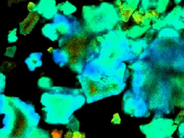 Флуоресценция клеток организма поможет определить границы опухолей