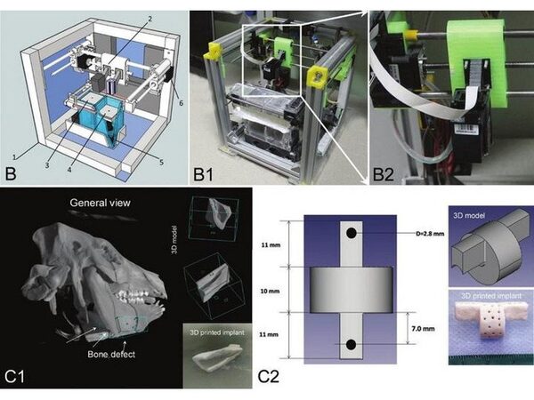 Создана технология трехмерной печати генетически активируемых костных имплантатов
