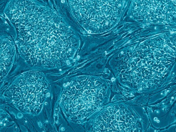 Нейросеть поможет вырастить сетчатку из стволовых клеток
