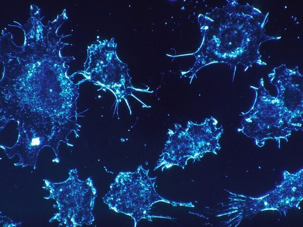 Кокарбоксилаза подавляет клетки опухоли, не действуя на здоровые клетки