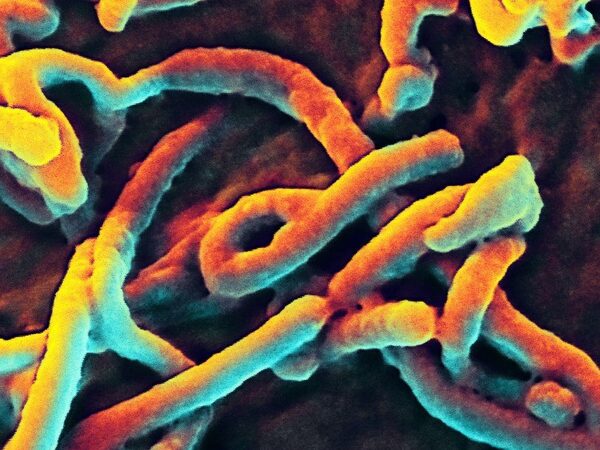 Вирус лихорадки Эбола может годами сохраняться в мозге человека