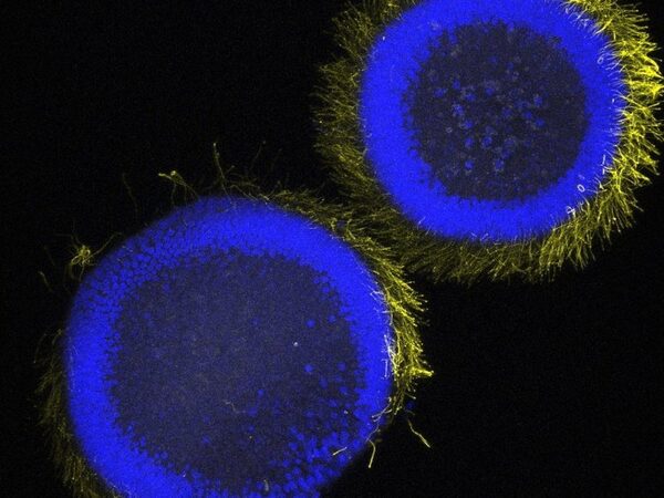 Открытый учеными белок помогает личинкам губок стать взрослыми