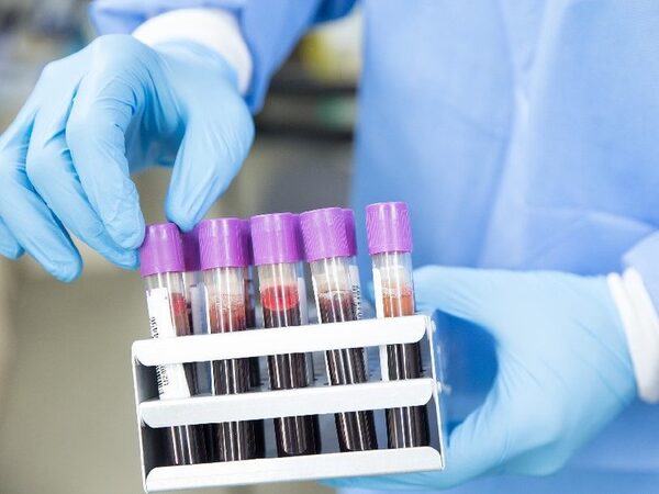 Клиническое исследование подтверждает эффективность генной терапии гемофилии