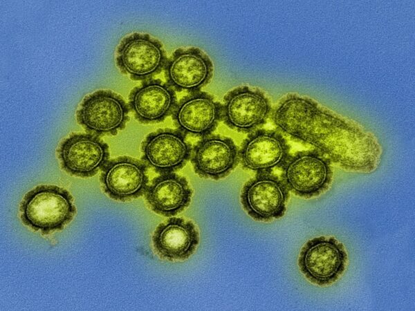 Новый краситель помогает быстро и точно выявить вирус гриппа
